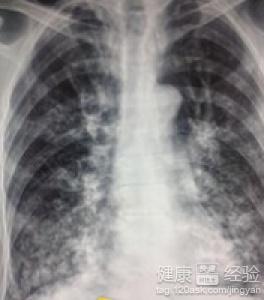 技术进出口 第13页